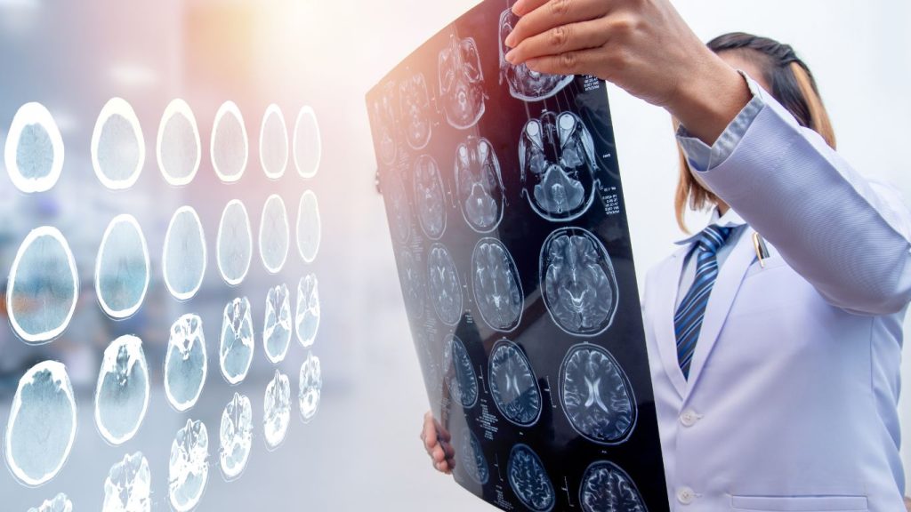 brain injury attorney
